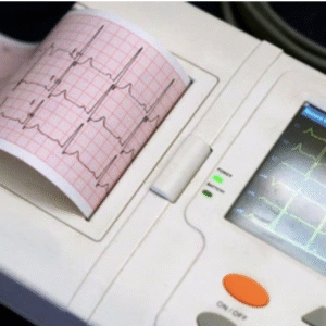 Quick ECG Review