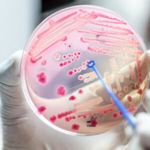 Bloodborne Pathogens